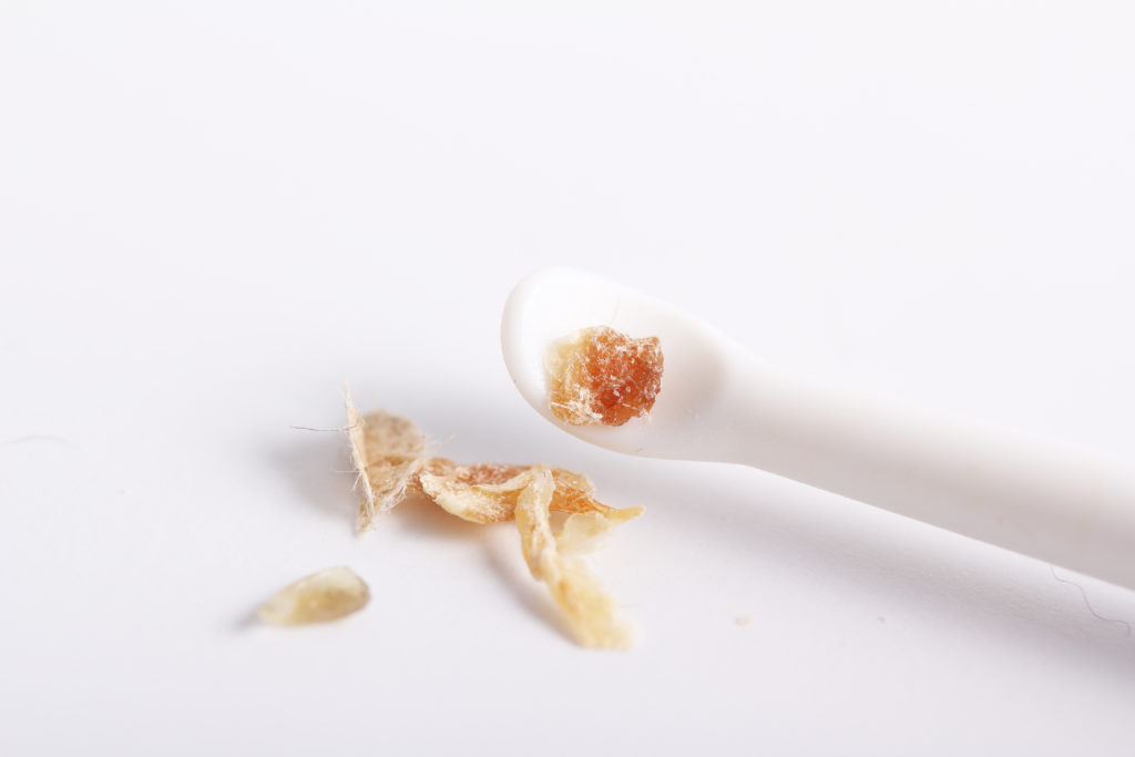 Earwax that has been extracted using an earwax pick