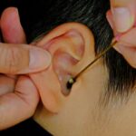 earwax build up teddington