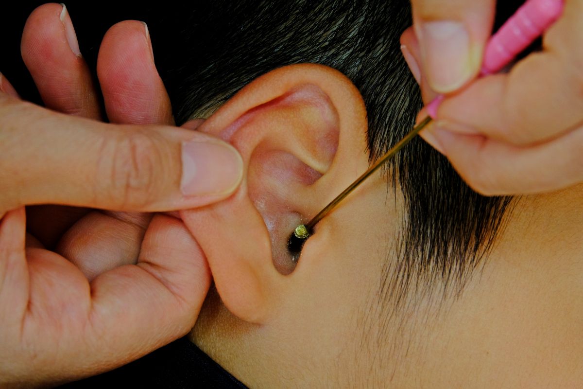 earwax build up teddington