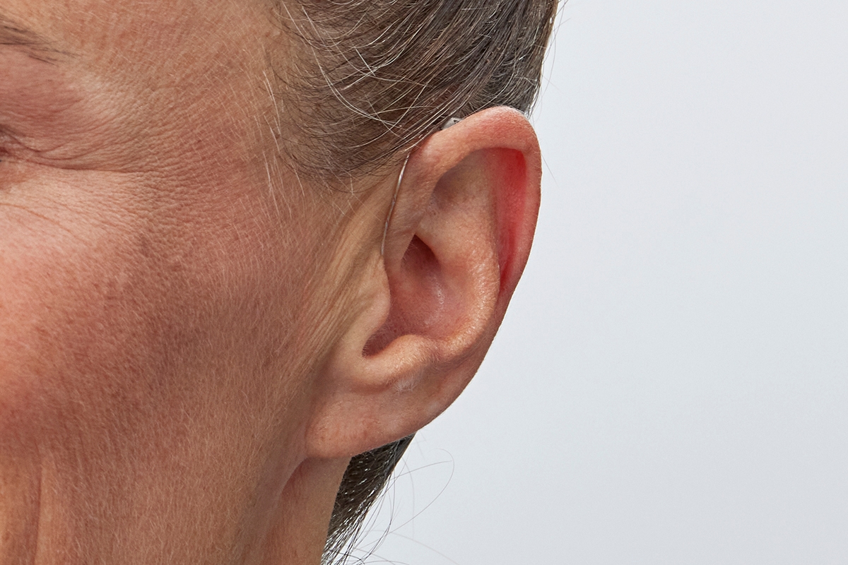 Oticon Intent worn in the ear